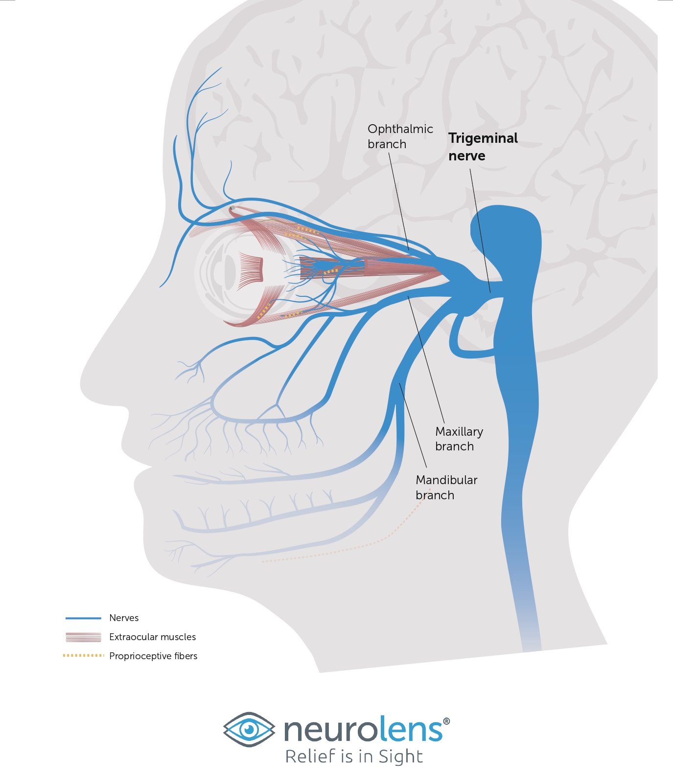 Trigeminal Nerve Graphic to explain how neurolens works