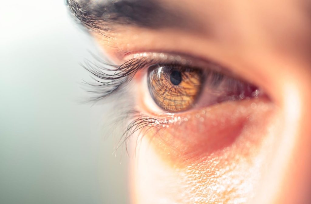 a macro close-up of an eye of a person who has undergone IPL treatments for their dry eye.
